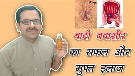 anal pain in hindi|piles treatment in hindi.